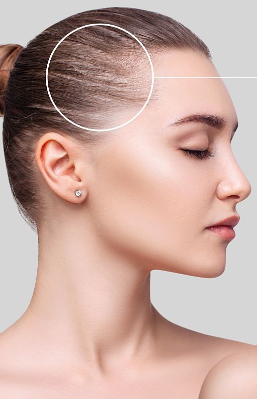 Leczenie łysienia Łódź Leczenie łysienia Łódź